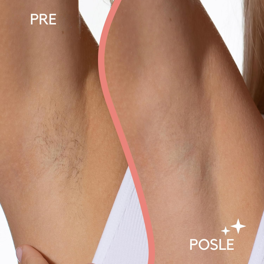 Električni Brijač Za Sve Delove Tela